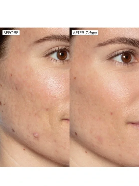 Sunday Riley Sample/Mini Pack Bundle - Picture 4 of 5